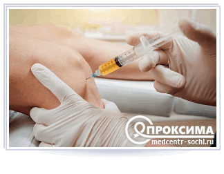 Методика внутрисуставного введения препарата