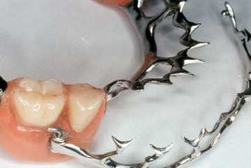 shiniruyuschiy bugel