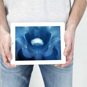 Уретроскопия