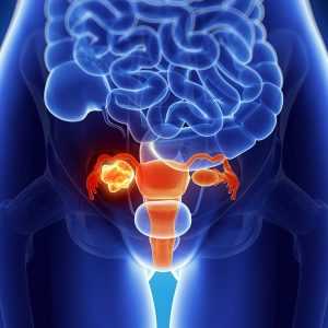 Мочевой пузырь