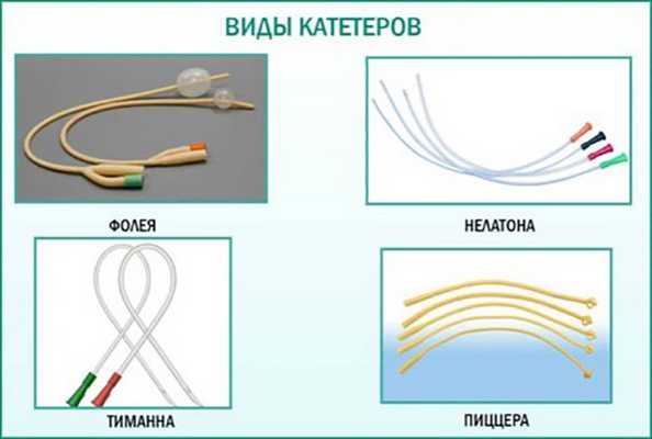 Виды мочевых катетеров 4 типа