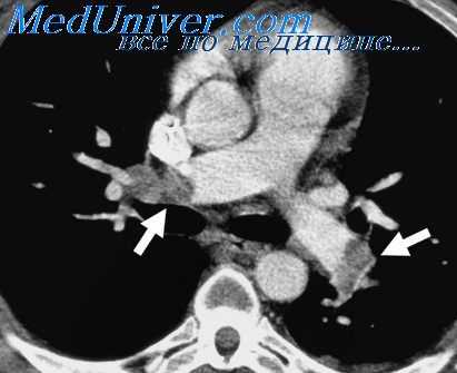 зондирование сердца