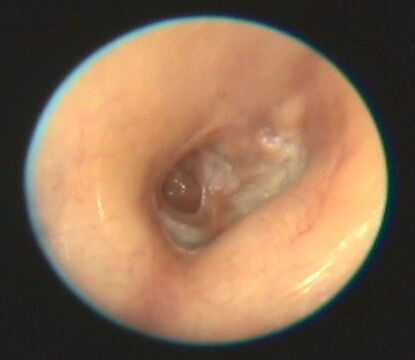 7-ой день после лечения