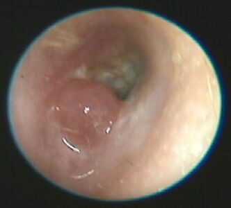 В день обращения