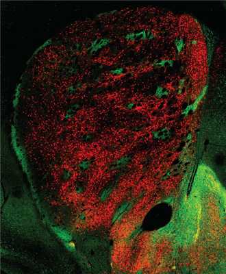 Стриосомы (зелёные) и матрица (красная)
