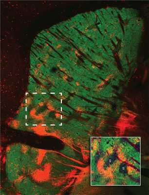 «Островки» стриосом (чёрные) в полосатом теле (зелёном) окружены структурами в форме колец (оранжевыми). Их функция пока неизвестна