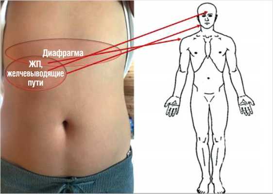 Рисунок 8. Схема иррадиации боли при патологии диафрагмы и билиарного тракта