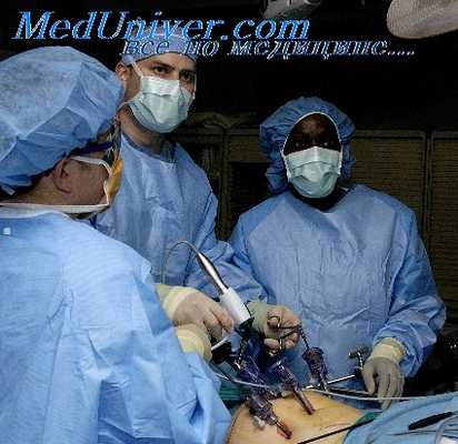 пневмоперитонеум