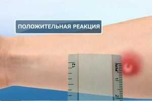 вид положительной реакции на тест