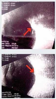 rezultatyi analizov krovi na gormoni491220