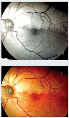 rezultatyi analizov krovi na gormoni491220