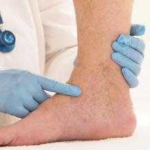 Озонотерапия во флебологии