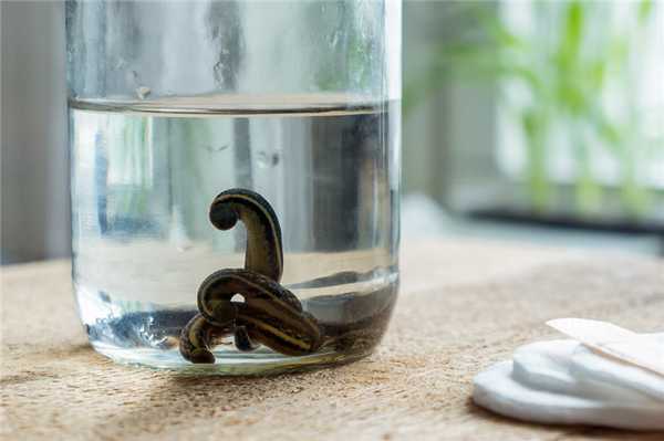 Топ-5 мифических причин бояться гирудотерапии