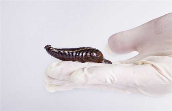 Чем уникальны медицинские пиявки?
