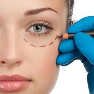 Мешки под глазами