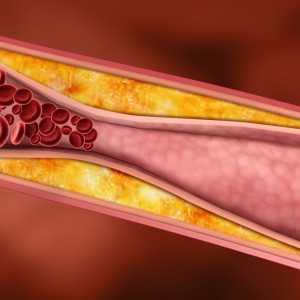 Холестерин в организме