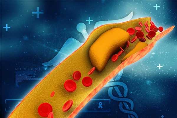 Холестерин питания и собственный: польза и риски