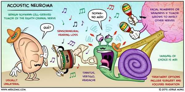 Механизм развития невриномы слухового нерва