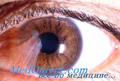 анилиновые красители