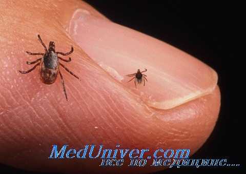 бабезиоз глаз