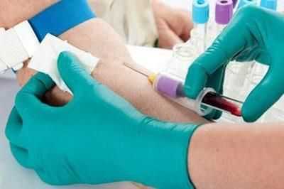 Забор крови