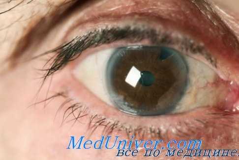 влияние нефтепродукта на зрение