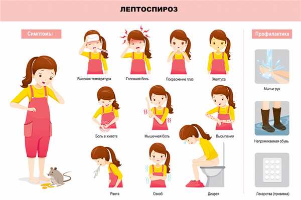 Симптомы лептоспироза.jpg