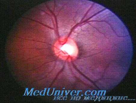 поражение глаз на производстве меди