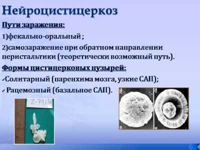 нейроцистицеркоз пути заражения