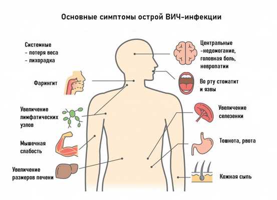 Онсовные симптомы ВИЧ.jpg