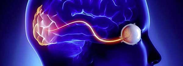 неврит глазного нерва