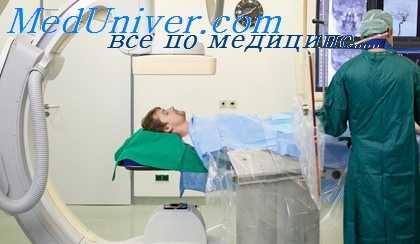 анатомия мозговых сосудов