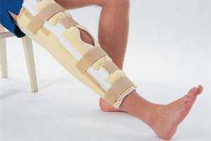 перелом подколенника