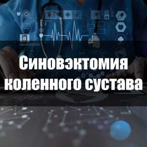 Синовэктомия коленного сустава