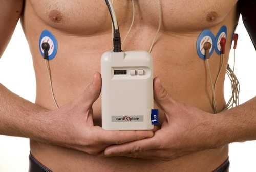 суточное мониторирование ад