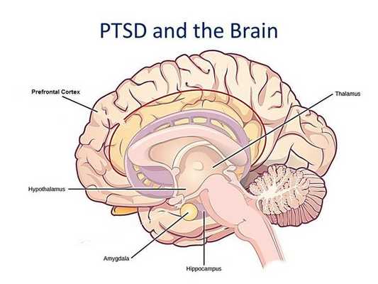 Активность головного мозга при посттравматического стрессового расстройства
