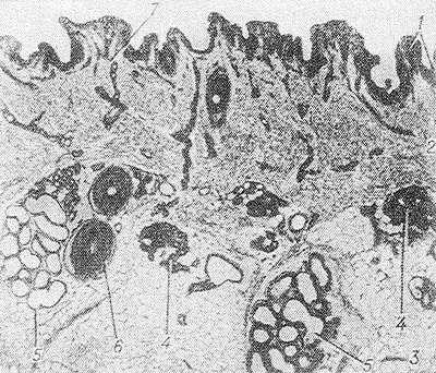 Рис. 2. Микропрепарат кожи подмышечной области: 1 — эпидермис, 2 — дерма, 3 — подкожная клетчатка, 4 — концевая часть эккринной потовой железы, 5 — концевая часть апокринной потовой железы, 6 — волос, 7 — потовый проток; окраска гематоксилин-эозином; х 100.