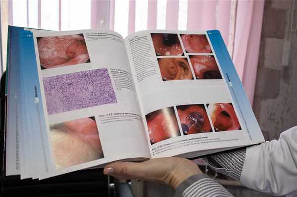 Как же понять, что гастрит именно антральный?