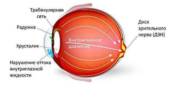 Офтальмогипертензия обоих глаз