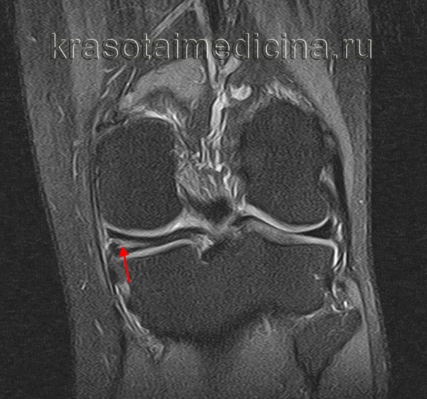 Глазков Юрий Константинович