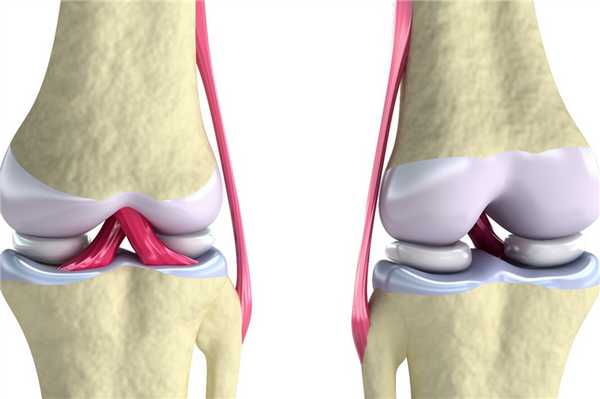 классификации повреждений 