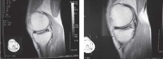 мрт-диагностика