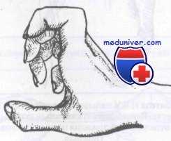 повреждения сухожилий кисти