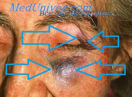 болезнь позвоночника