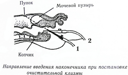 Можно ли похудеть с помощью очистительной клизмы?
