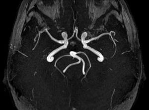Паталогии ВК