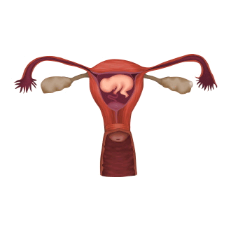  Предлежание плаценты