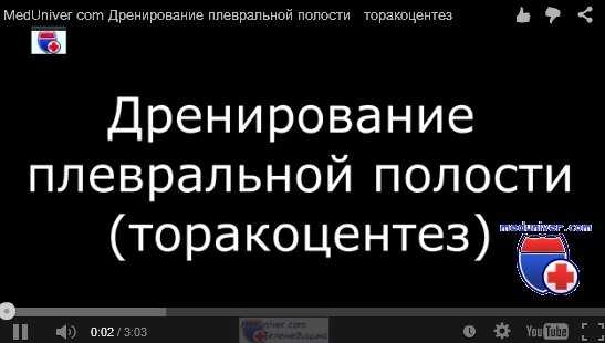 дренирование плевральной полости