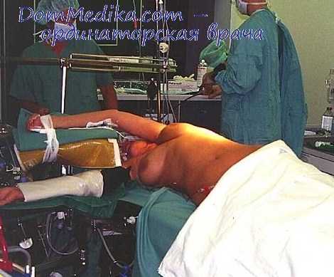 резекция легкого