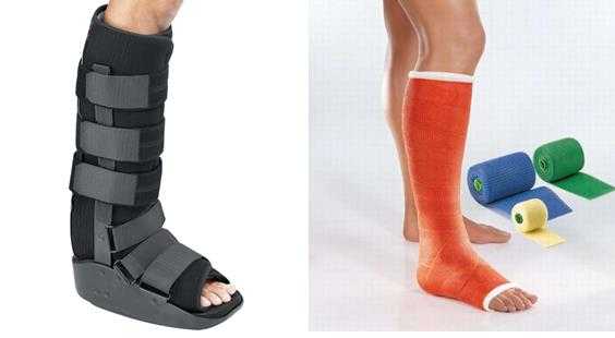 гипс после операции на суставе лисфранка